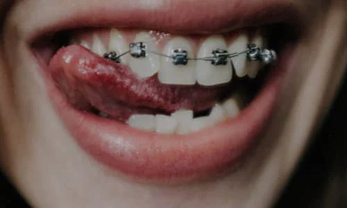 Perth periodontal specialists